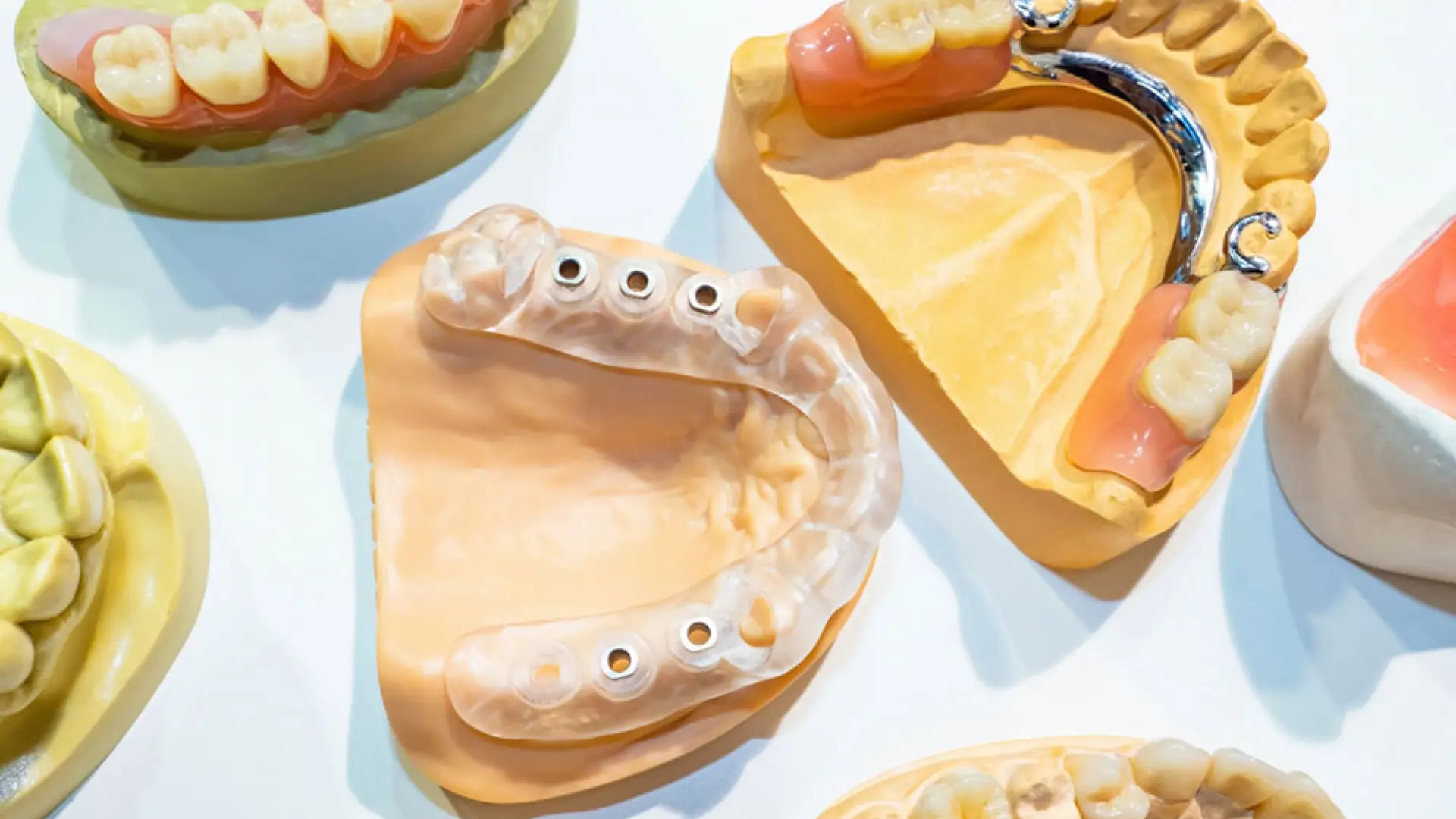 Best Dentist in Penrith | Trusted & Affordable Dental Care 4 slider3 Penrith Dental Care