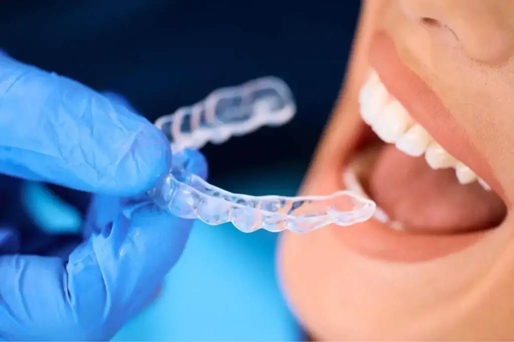 What Can You Eat With Braces? (And Can You Chew Gum?) 1 Clear aligner held beside a patient's smile