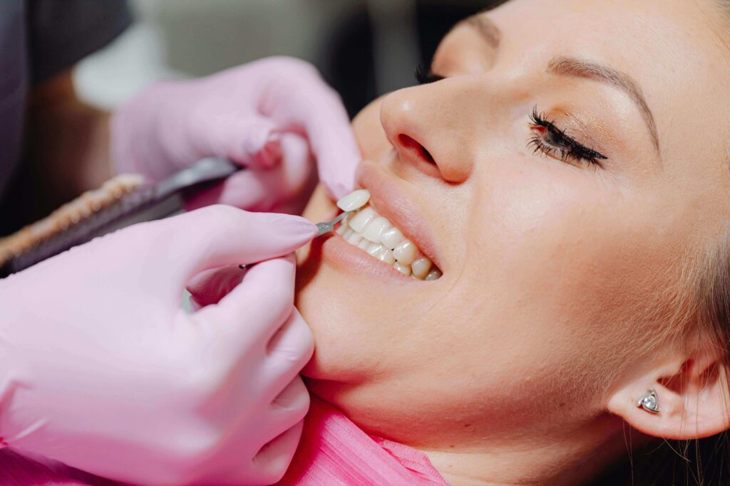 Teeth Whitening at Home: What Works and What to Avoid 1 Tooth shade guide held against a patient's teeth