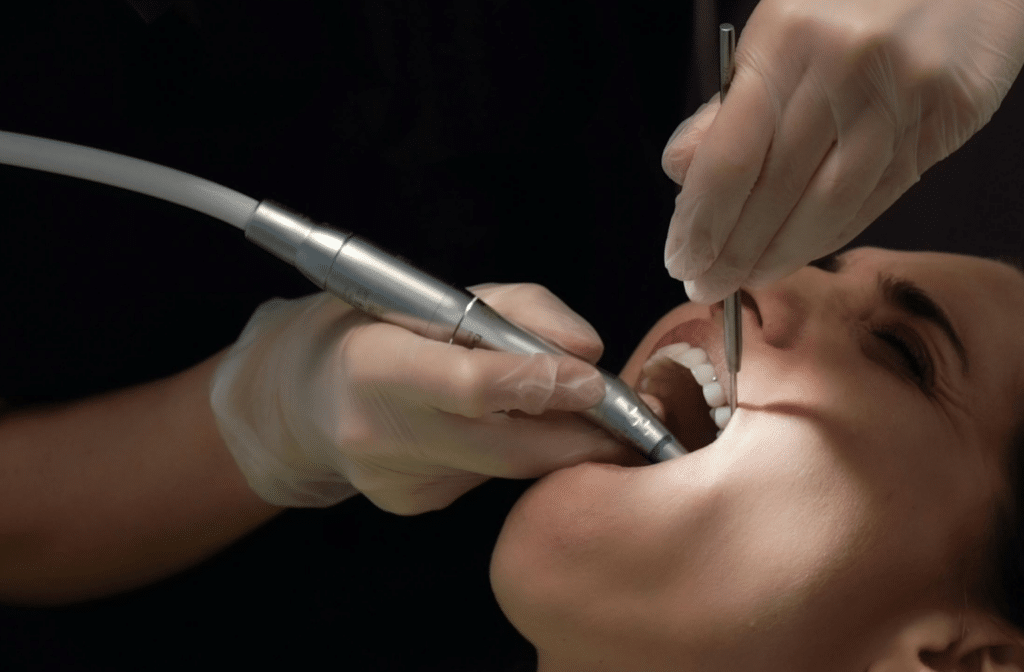 Tartar (Dental Calculus): What It Is and How It Is Removed 1 Dental practitioner cleaning a patient's teeth with a scaler