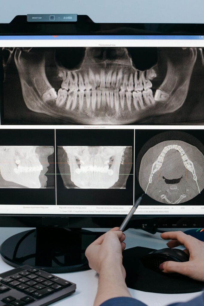 Dental X-Rays: What They Show and Why They Are Taken 1 Dental X-ray images of the teeth and jaws